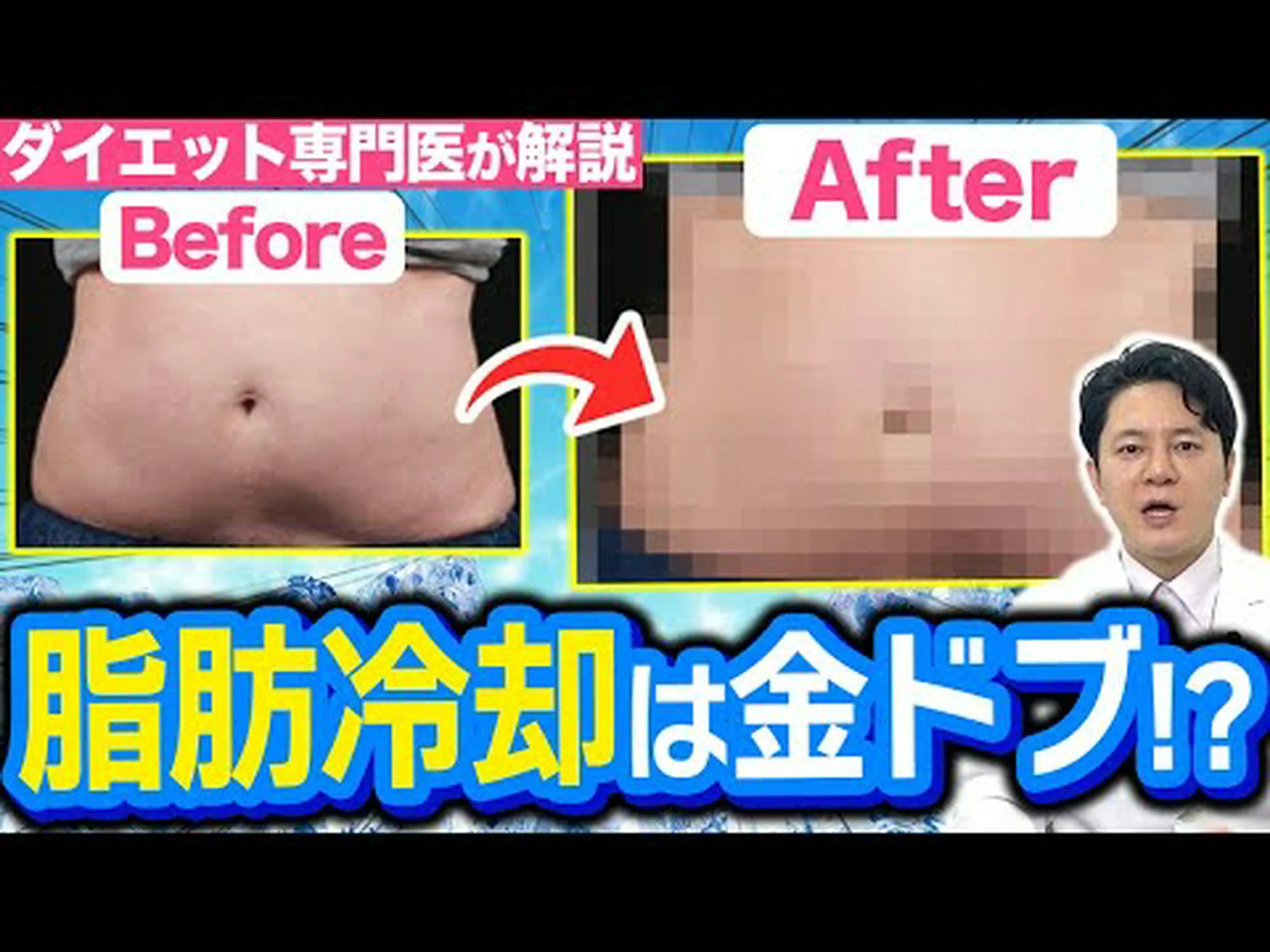 3Dリポって効果あるの?本当に痩せますか? 3Dリポって効果あるの?本当に痩せますか?