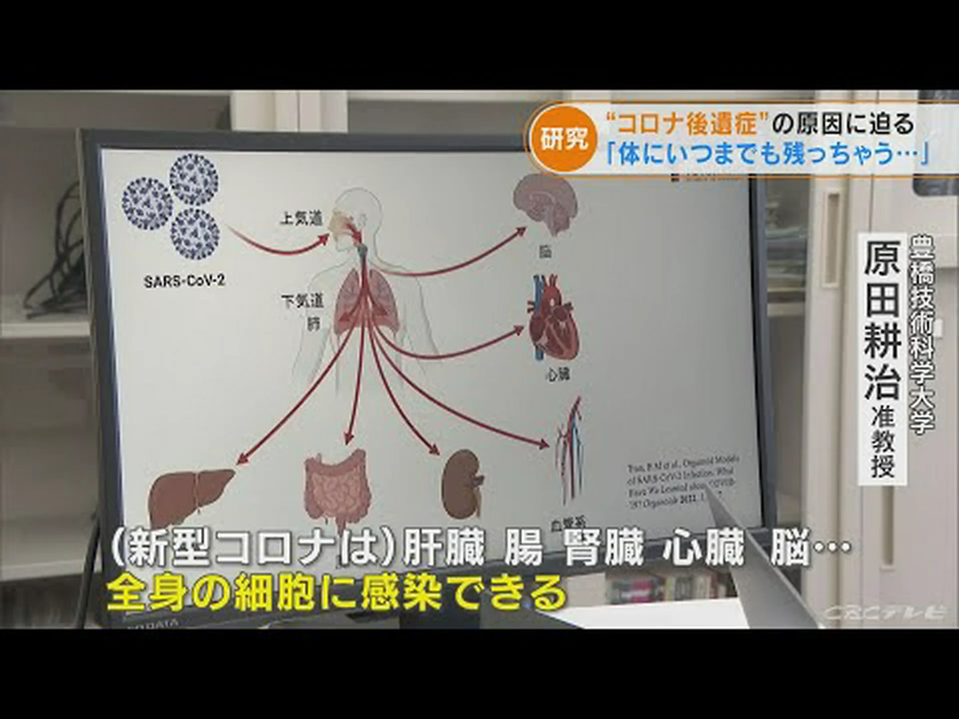 新型コロナウイルス感染症と勃起不全との関係性 新型コロナウイルス感染症と勃起不全との関係性