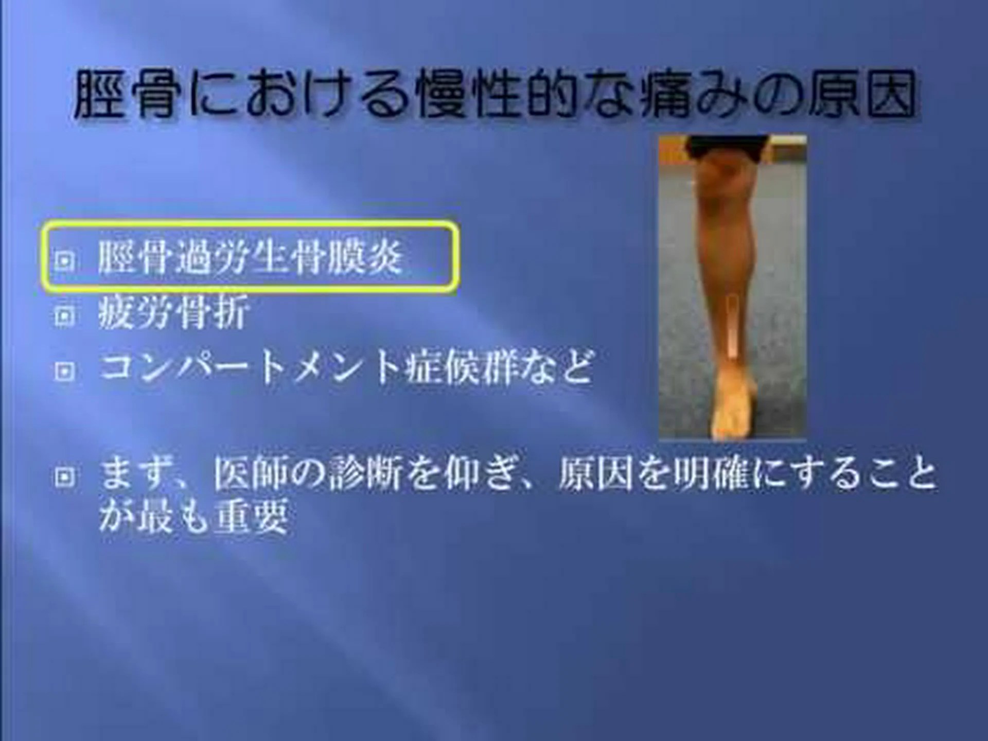 シンスプリント:考えられる原因と治療法 シンスプリント:考えられる原因と治療法