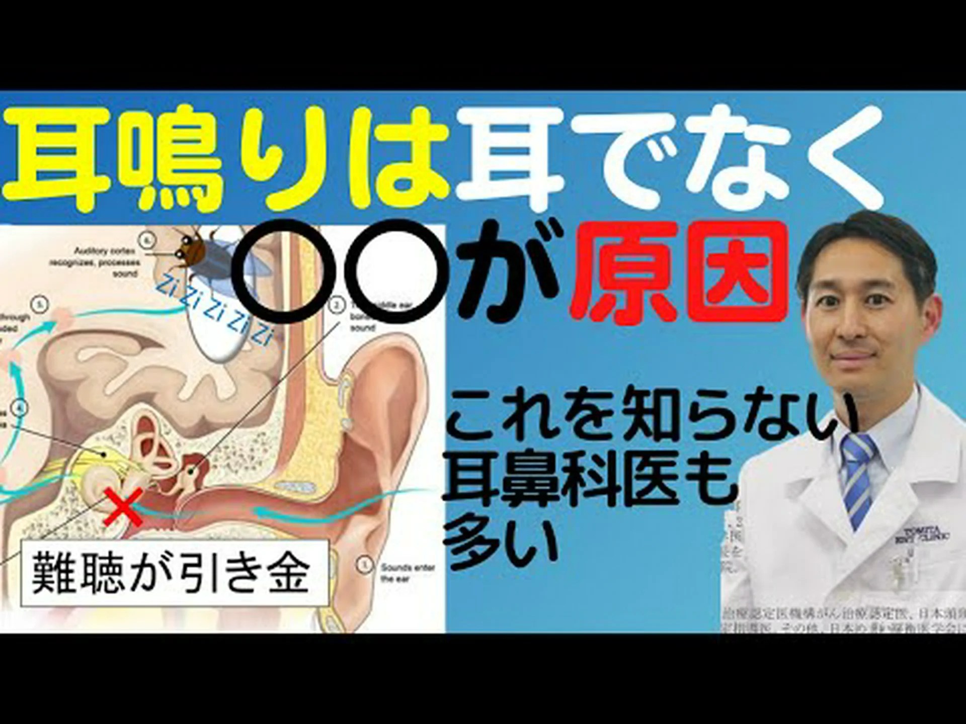 耳鳴り – 原因と対処法 耳鳴り – 原因と対処法