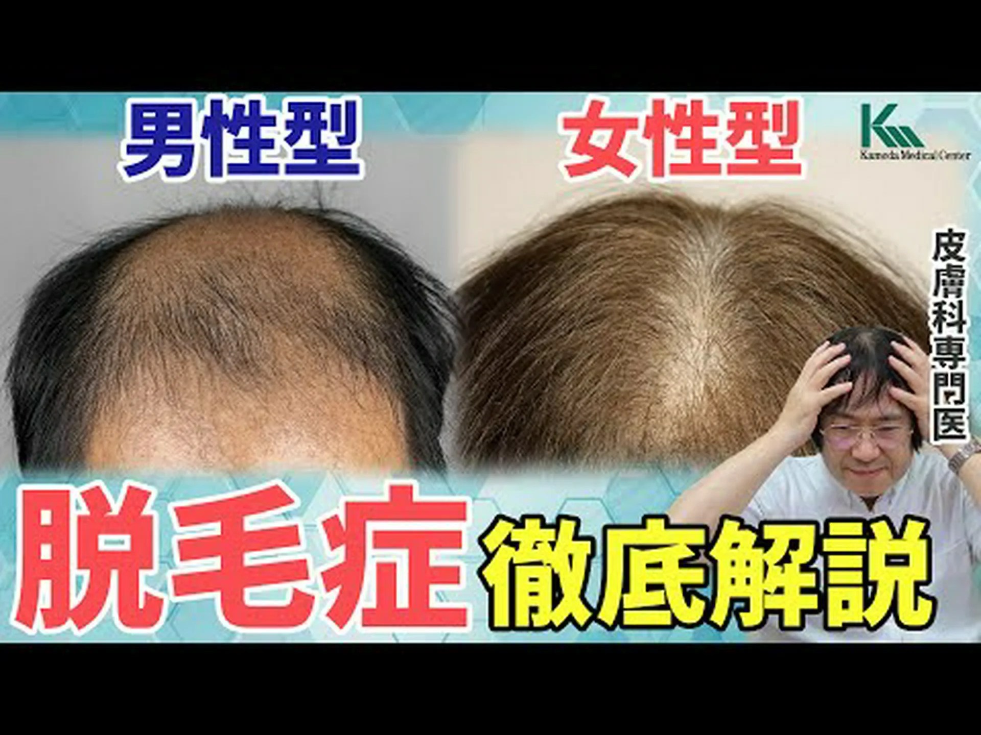 マイアラとマライーサに加えて、脱毛症の有名人をもっと見る マイアラとマライーサに加えて、脱毛症の有名人をもっと見る