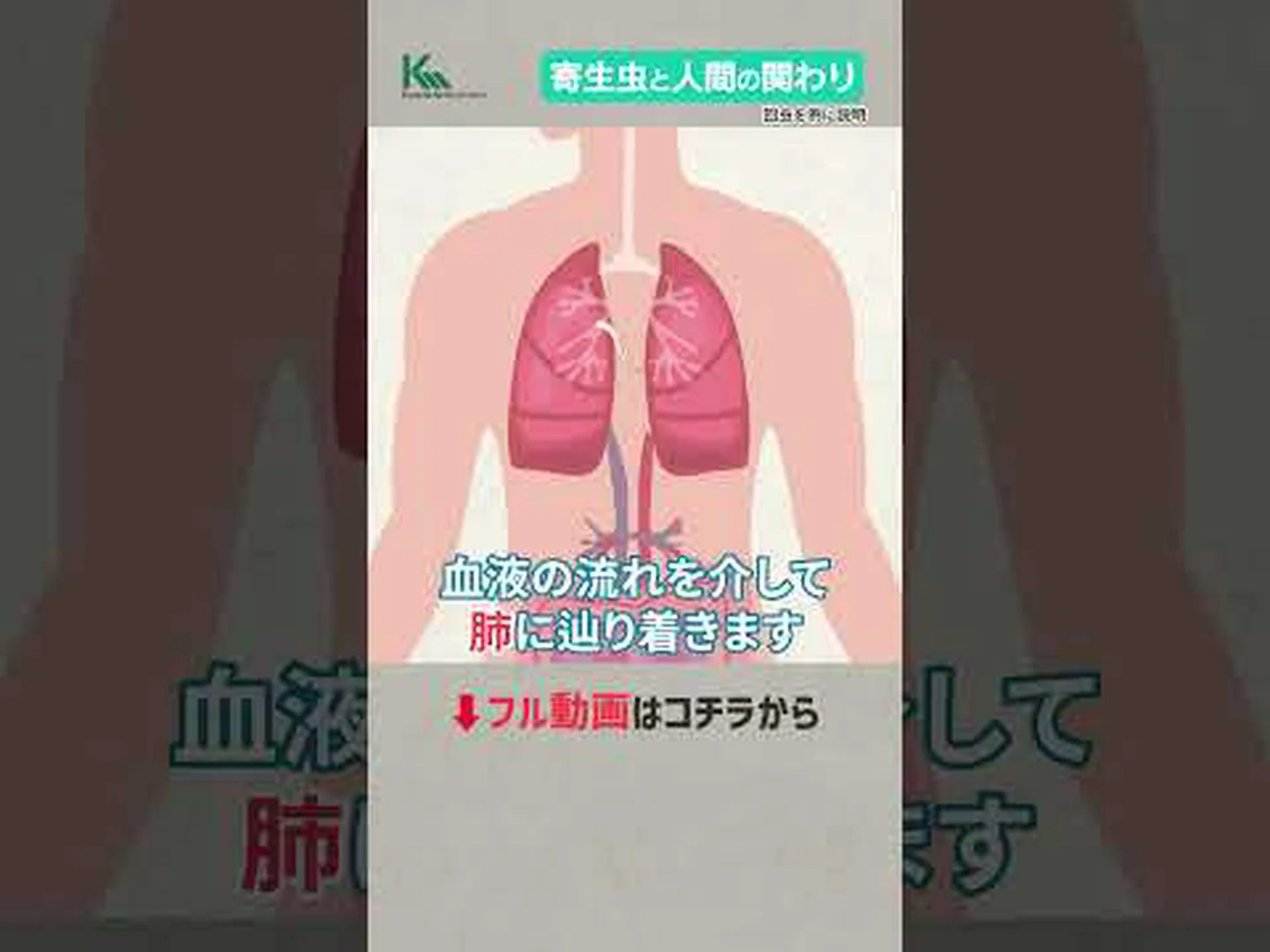 腸内寄生虫に対する10の家庭療法 腸内寄生虫に対する10の家庭療法