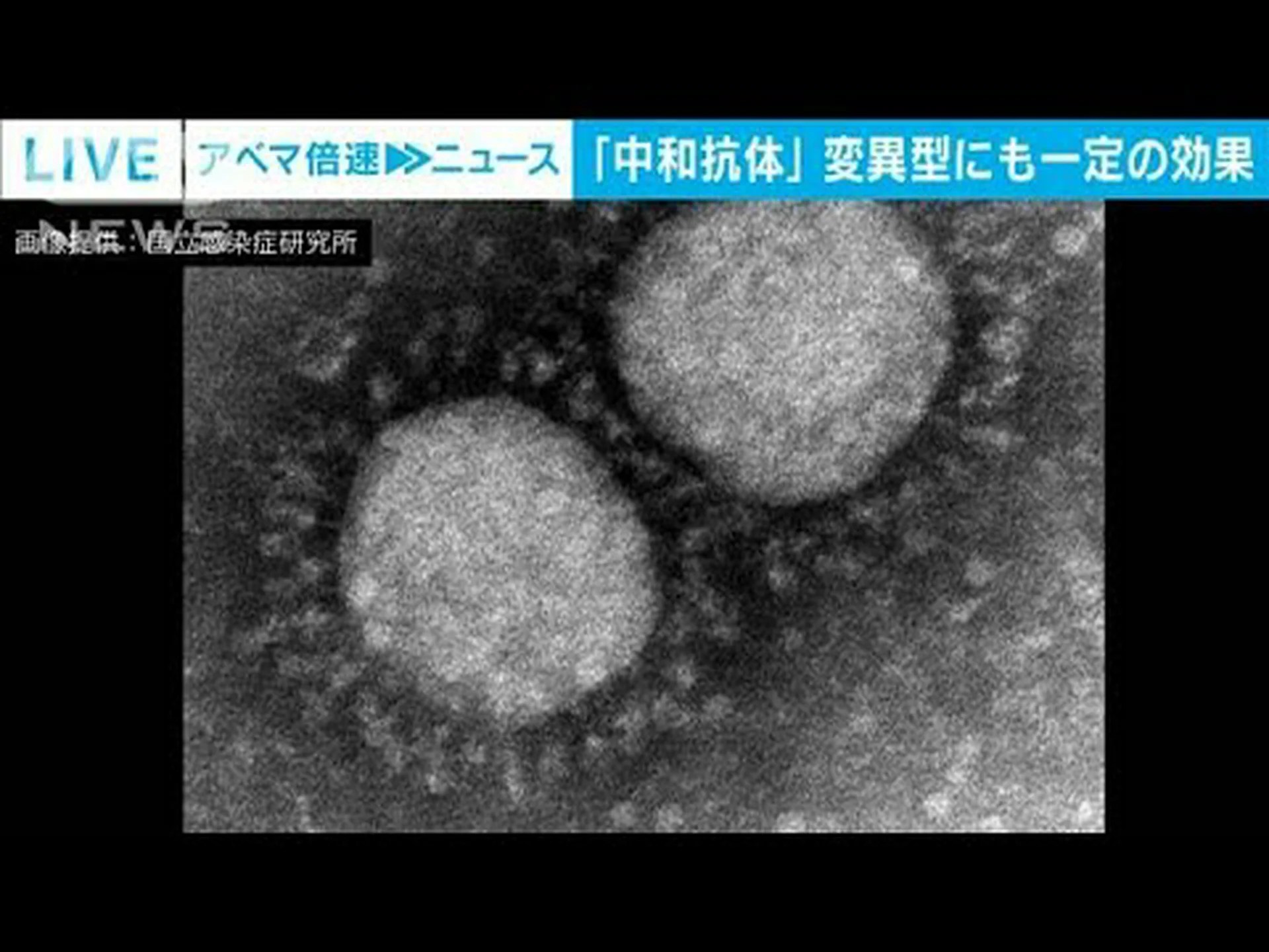 新型コロナウイルスの抗体は最長6か月持続する可能性があることが研究で判明 新型コロナウイルスの抗体は最長6か月持続する可能性があることが研究で判明
