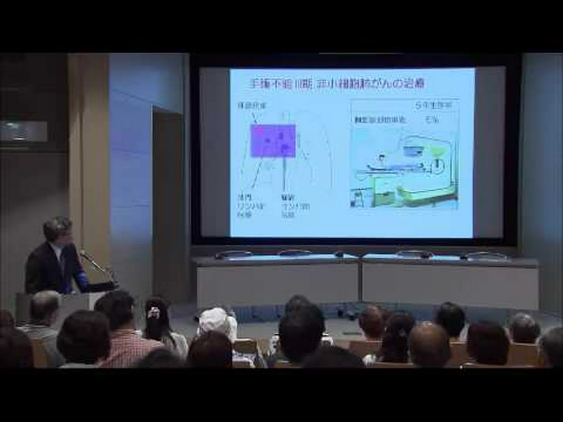 指のほくろは肺がんを示している可能性があります。もっと詳しく調べてください! 指のほくろは肺がんを示している可能性があります。もっと詳しく調べてください!