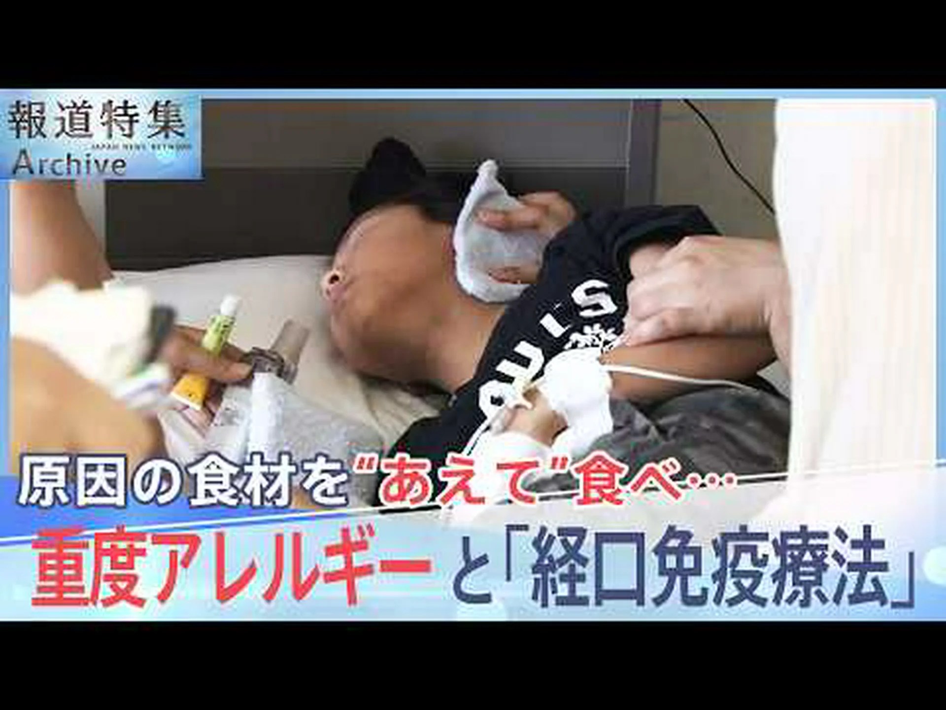 食物アレルギーの症例が増加している – 専門家が説明 食物アレルギーの症例が増加している – 専門家が説明