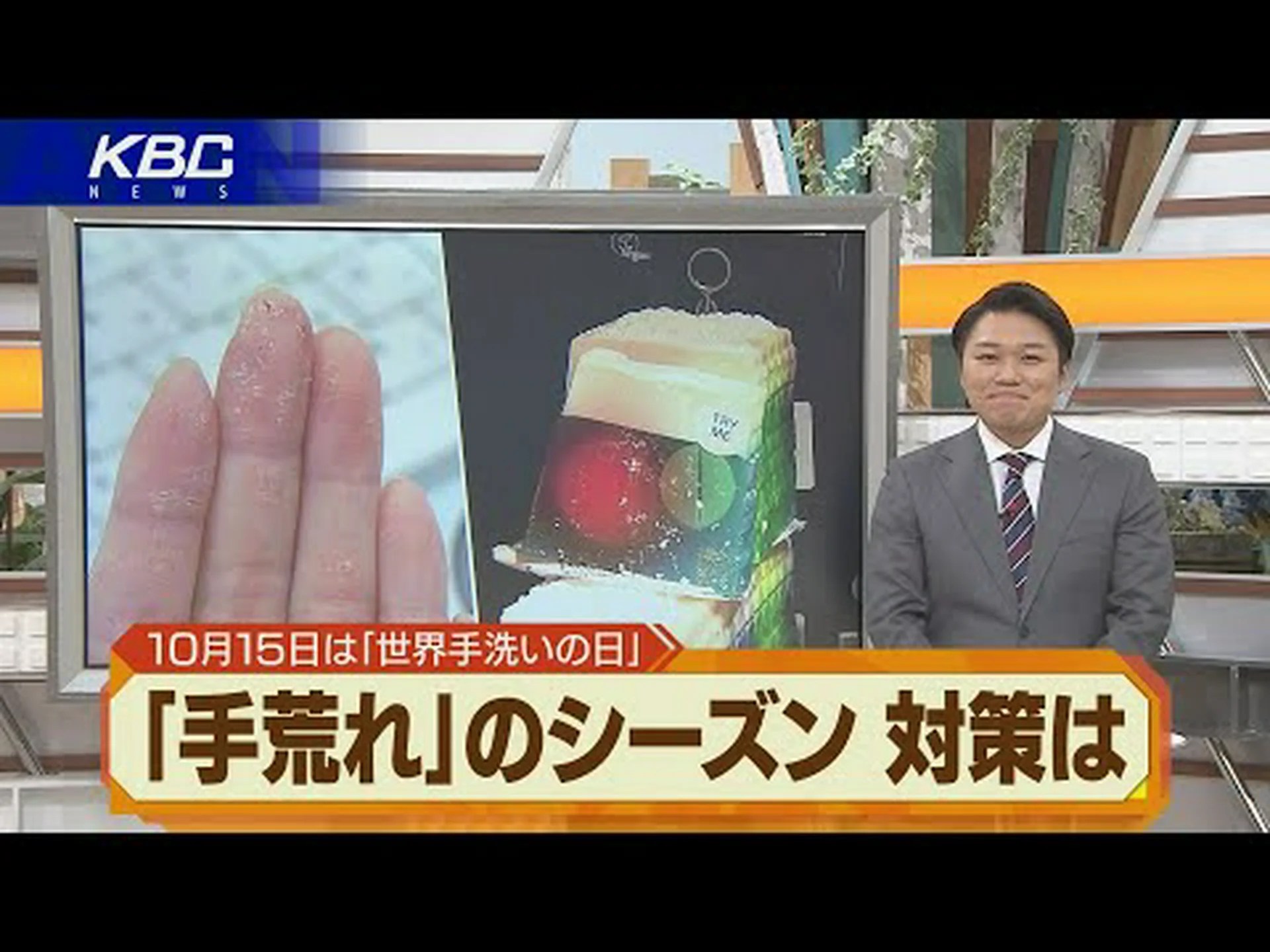 コロナウイルス対策で洗いすぎて手が乾燥?何をすべきかを知る コロナウイルス対策で洗いすぎて手が乾燥?何をすべきかを知る