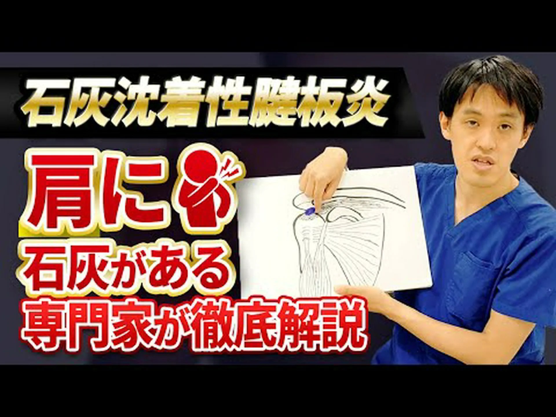 最もよく使われる腱炎の治療法12選 最もよく使われる腱炎の治療法12選