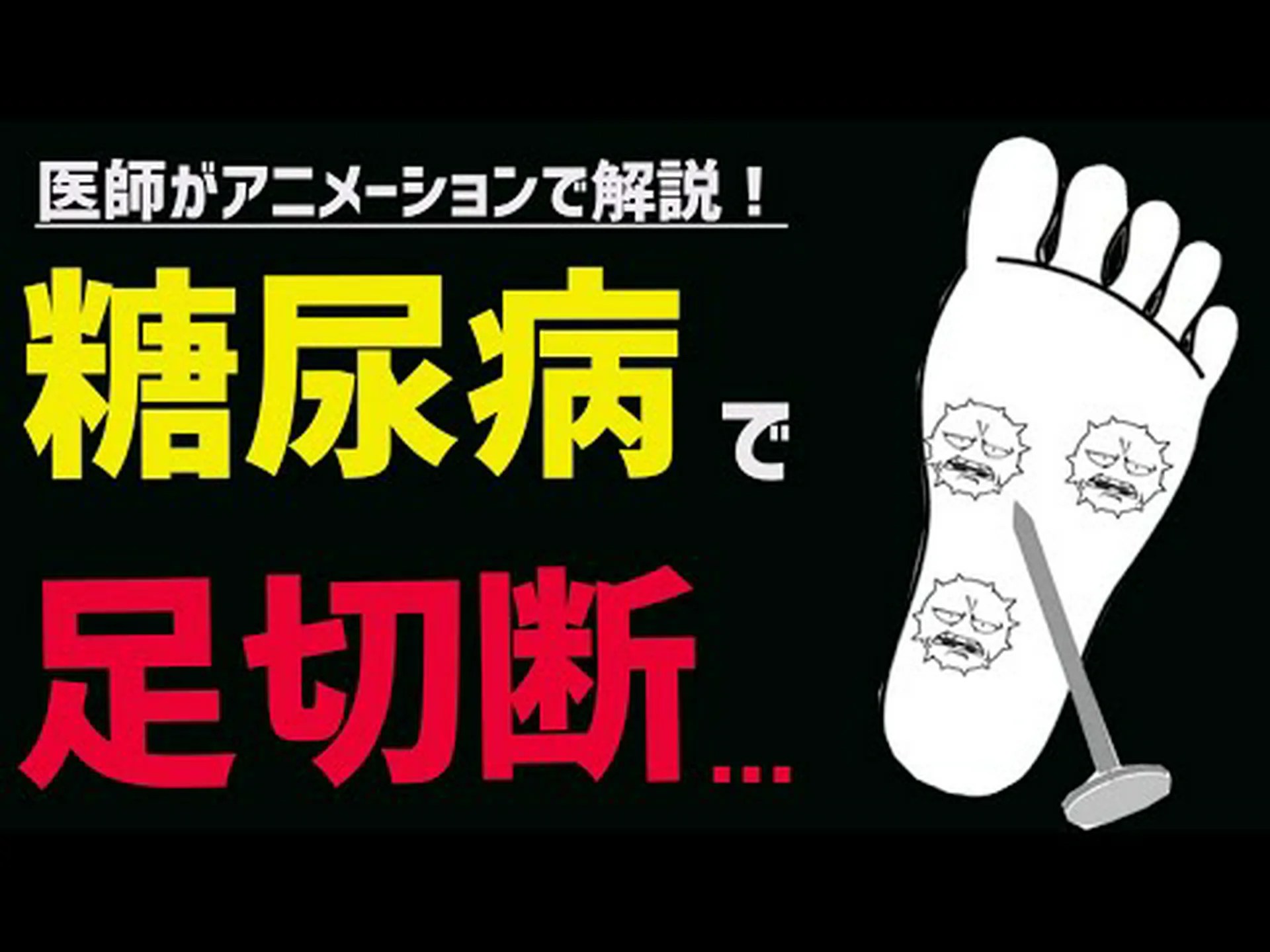 シンガーは糖尿病の合併症のためかかとと4本の指を切断 シンガーは糖尿病の合併症のためかかとと4本の指を切断