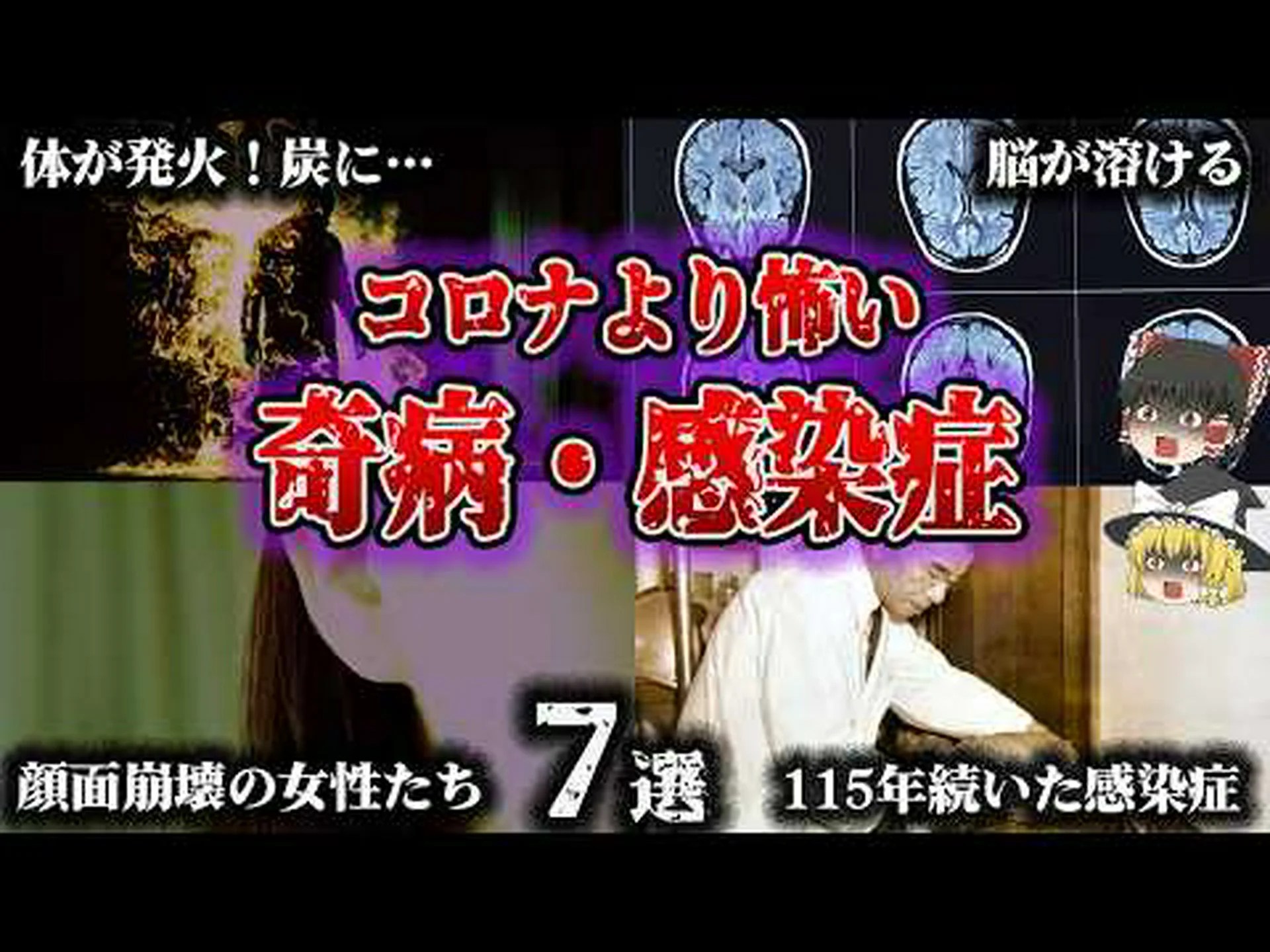男性は歯に感染症を患い、細菌に感染し、目を失いそうになる 男性は歯に感染症を患い、細菌に感染し、目を失いそうになる