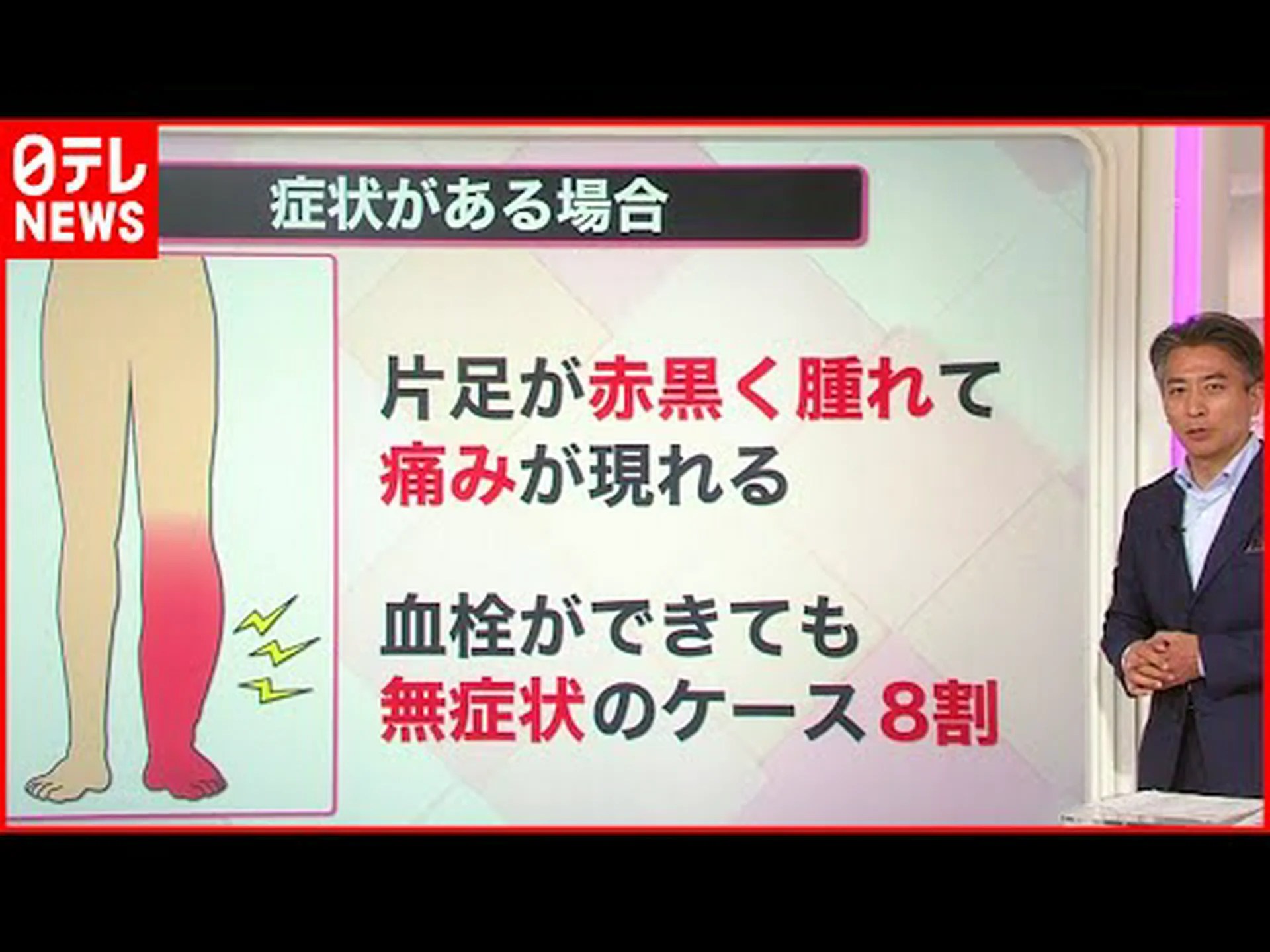 若い女性が足に赤い斑点があるのに気づき、避妊薬が原因で60cmの血栓があると診断される 若い女性が足に赤い斑点があるのに気づき、避妊薬が原因で60cmの血栓があると診断される