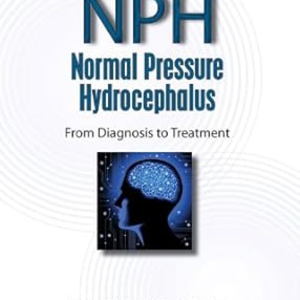 Essential Insights and Comprehensive Guide: Normal Pressure Hydrocephalus: From Diagnosis to Treatment Essential Insights and Comprehensive Guide: Normal Pressure Hydrocephalus: From Diagnosis to Treatment