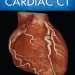 Essential Insights: A Comprehensive Review of The Complete Guide To Cardiac CT (PB) for Medical Professionals Essential Insights: A Comprehensive Review of The Complete Guide To Cardiac CT (PB) for Medical Professionals