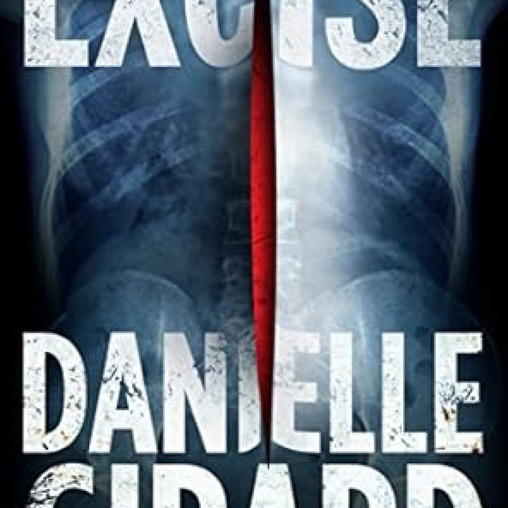 Unforgettable and Gripping: A Review of Excise (Dr. Schwartzman Book 2) Unforgettable and Gripping: A Review of Excise (Dr. Schwartzman Book 2)