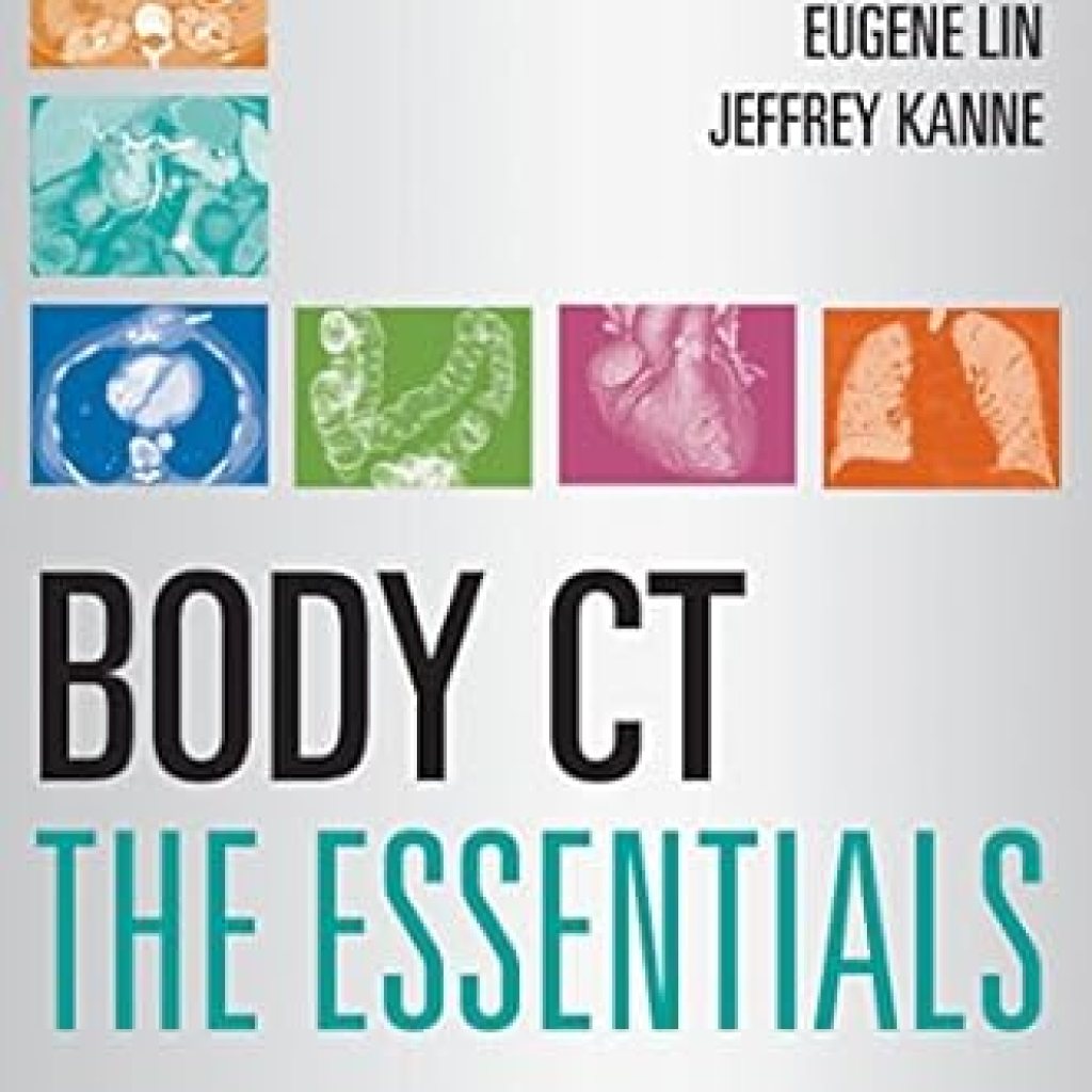 Comprehensive Review: Body CT The Essentials – Your Ultimate Guide to Mastering Body CT Imaging Comprehensive Review: Body CT The Essentials – Your Ultimate Guide to Mastering Body CT Imaging
