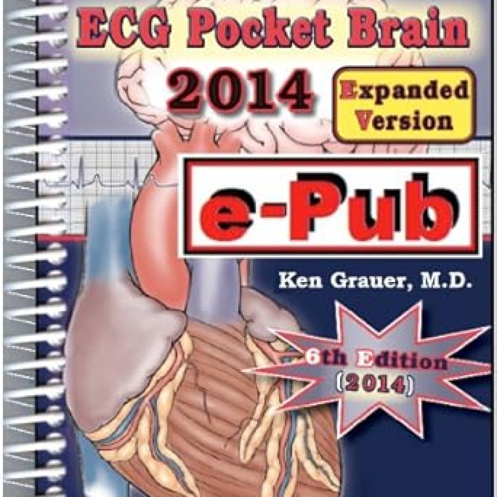 Unlock Your Cardiac Knowledge: A Comprehensive Review of ECG-2014-Pocket Brain (Expanded) Unlock Your Cardiac Knowledge: A Comprehensive Review of ECG-2014-Pocket Brain (Expanded)