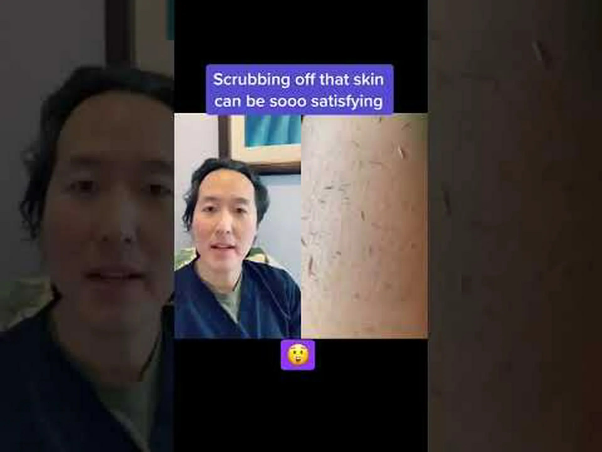 Korean exfoliating mitt Korean exfoliating mitt