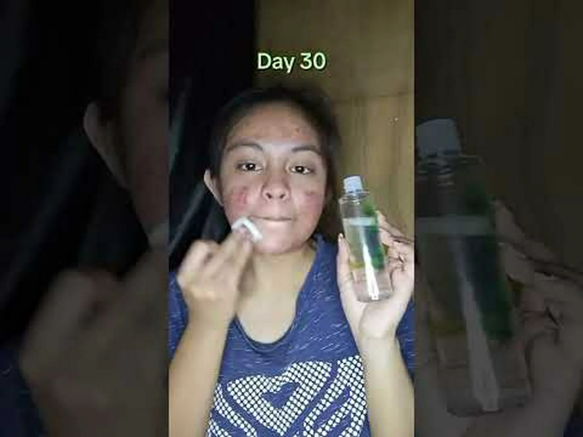 Centella asiatica skincare Centella asiatica skincare
