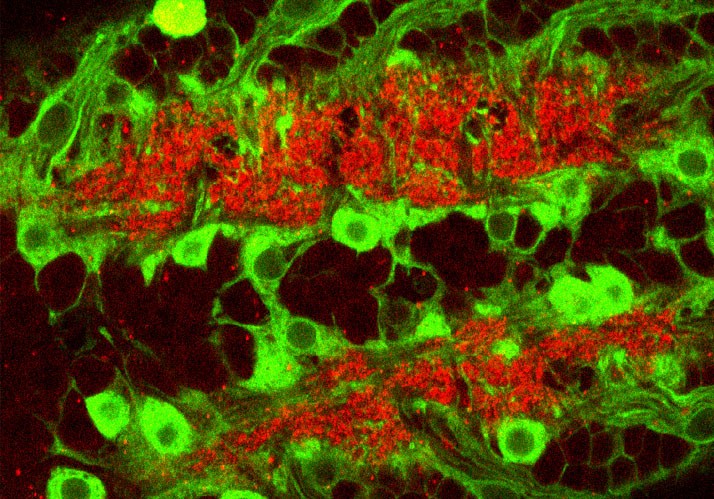 Was hält Neuronen fit? Kommunikation zwischen Hirnzellen Was hält Neuronen fit? Kommunikation zwischen Hirnzellen