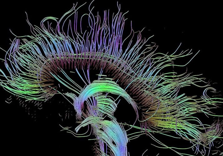 Symposium Kortizes 2020 | Connectomics: Karten des Denkens Können Computer vom Gehirn lernen? Symposium Kortizes 2020 | Connectomics: Karten des Denkens Können Computer vom Gehirn lernen?