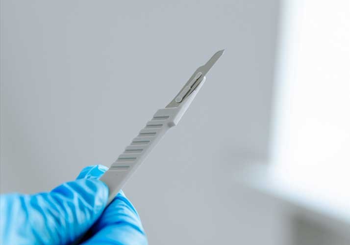 Was Sie schon immer über »Beschneidung« von Jungen wissen wollten – aber bisher nicht zu fragen wagten Was Sie schon immer über »Beschneidung« von Jungen wissen wollten – aber bisher nicht zu fragen wagten