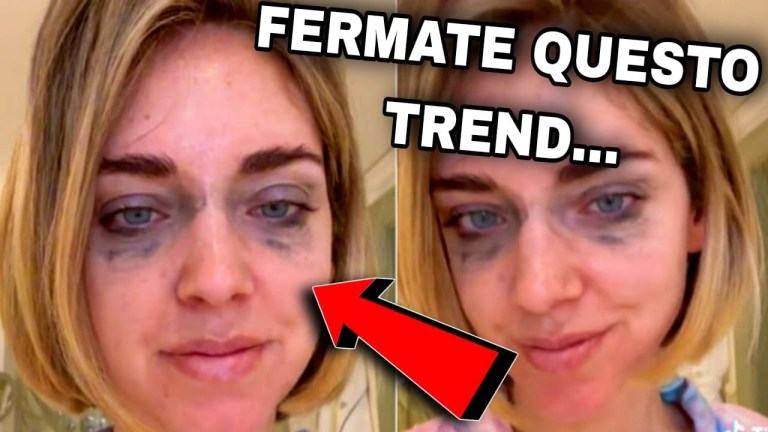 IL TREND DI CHIARA FERRAGNI DEVE ESSERE FERMATO. IL TREND DI CHIARA FERRAGNI DEVE ESSERE FERMATO.