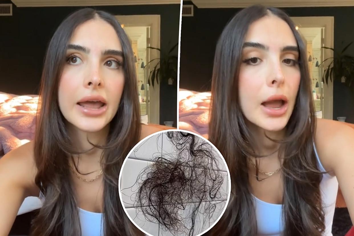 Sophia Umansky Reveals Hair Loss After Mounjaro Weight Loss Journey Sophia Umansky Reveals Hair Loss After Mounjaro Weight Loss Journey