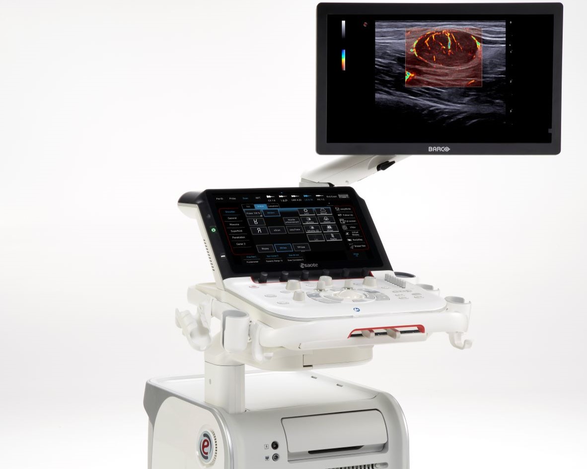 Esaote lancia il nuovo sistema ecografico premium MyLabX90 Esaote lancia il nuovo sistema ecografico premium MyLabX90