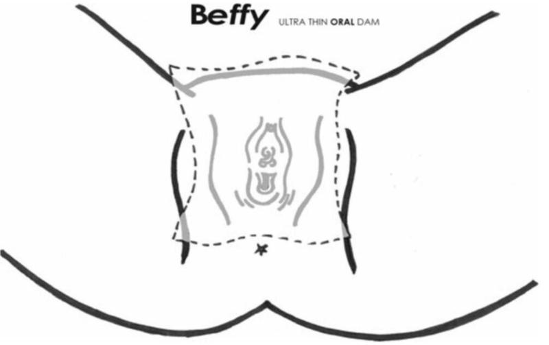 Beffy Lickpads