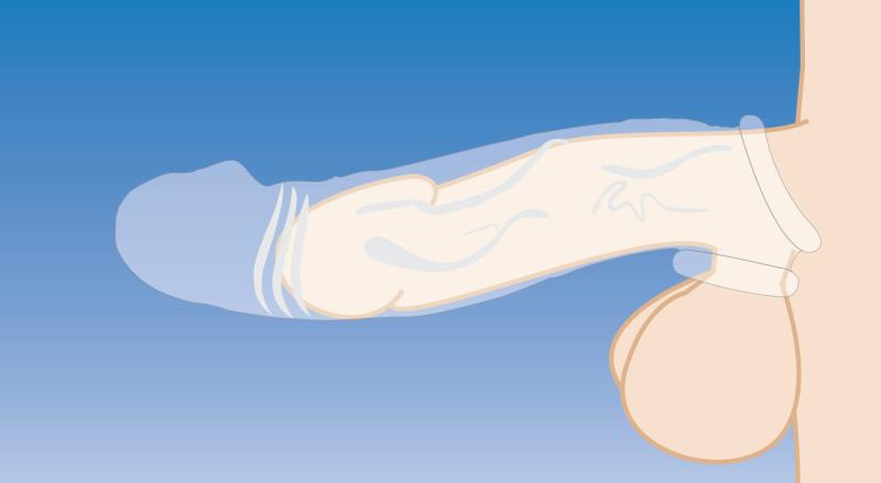 Size Matters »Clear Extender« gekrümmte Penishülle