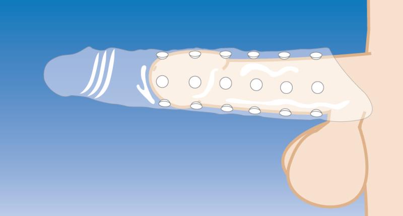 Size Matters verlängernde Penishülle mit innerer Noppenstruktur