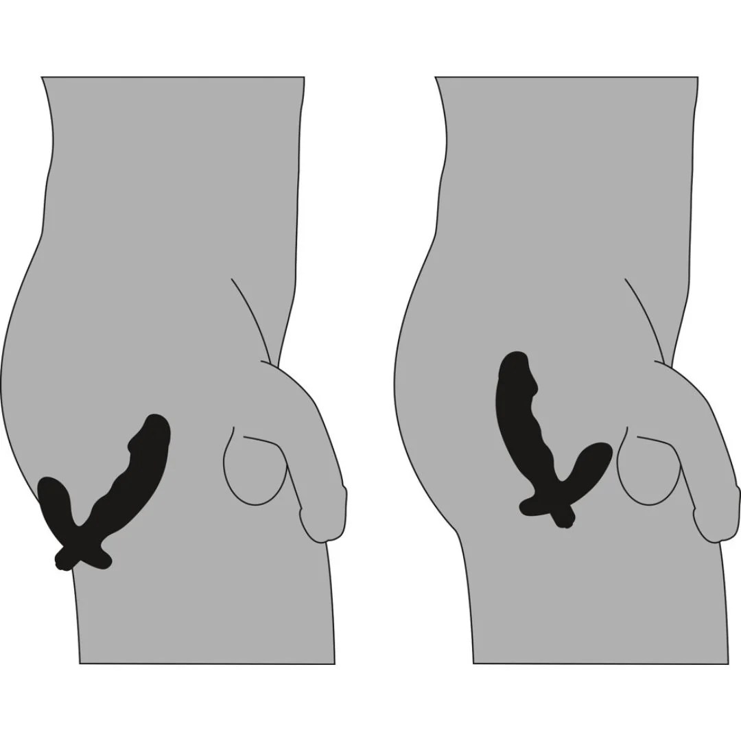 Prostatavibrator in Penisform