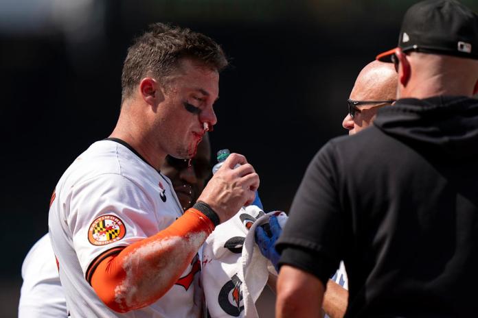 Orioles’ James McCann stays in game after taking fastball to his face Orioles’ James McCann stays in game after taking fastball to his face
