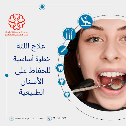 تحسين ابتسامتك في يوم واحد: تيجان الأسنان الفورية بتقنية السيريك في مركز ميديشي بالدوحة تحسين ابتسامتك في يوم واحد: تيجان الأسنان الفورية بتقنية السيريك في مركز ميديشي بالدوحة
