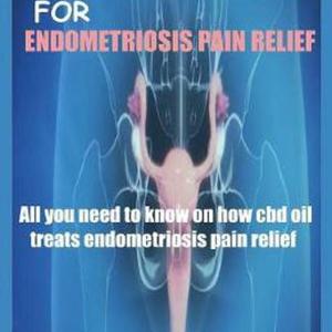 CBD Oil for Endometriosis Pain Relief: All You Need to Know on How Cbd Oil Treat CBD Oil for Endometriosis Pain Relief: All You Need to Know on How Cbd Oil Treat