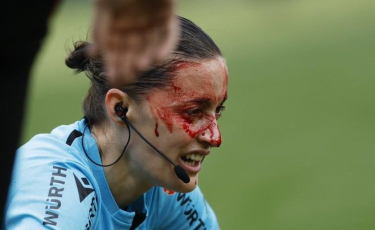 La asistente Guadalupe Porras, retirada en camilla tras un golpe con una cámara de televisión La asistente Guadalupe Porras, retirada en camilla tras un golpe con una cámara de televisión