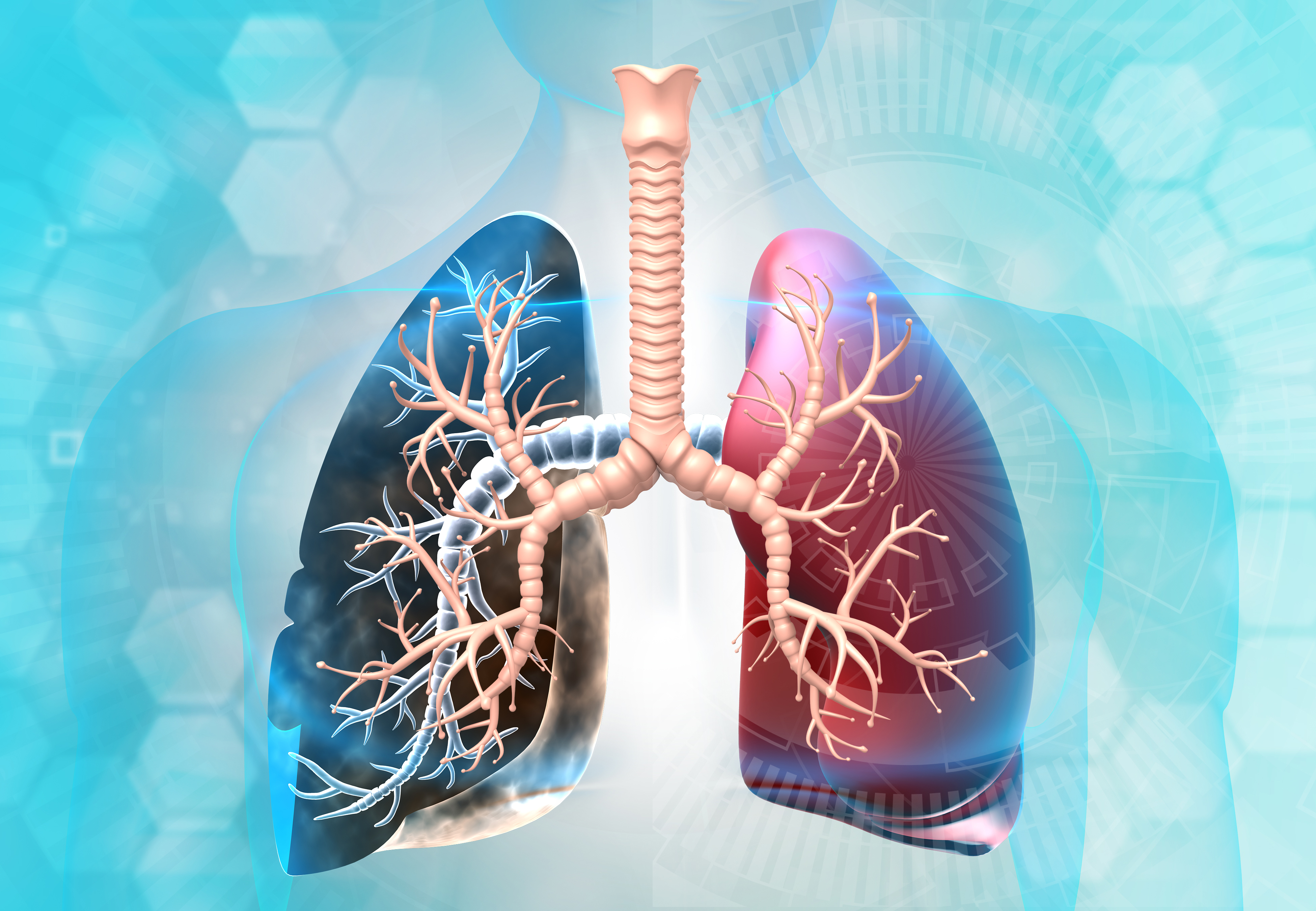 Understanding Pulmonary Fibrosis: Causes, Symptoms, and Risk Factors Understanding Pulmonary Fibrosis: Causes, Symptoms, and Risk Factors