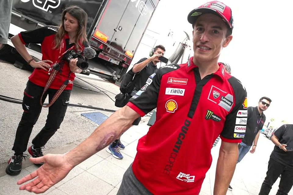Marc Marquez can solely “survive” in Spanish GP regardless of return to full health Marc Marquez can solely “survive” in Spanish GP regardless of return to full health