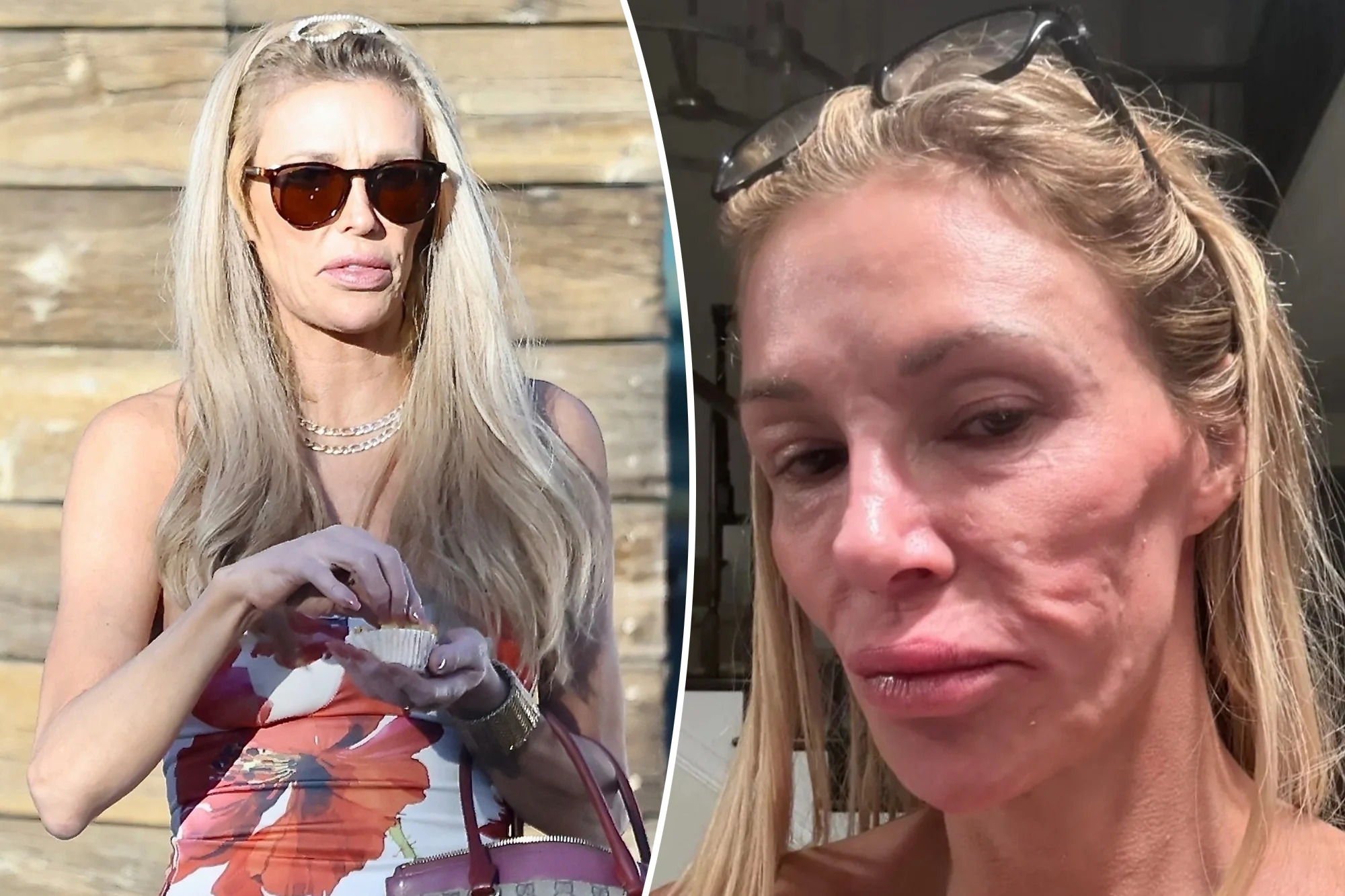 ‘Thrilled’ Brandi Glanville says she finally received diagnosis for face disfigurement after blaming parasite ‘Thrilled’ Brandi Glanville says she finally received diagnosis for face disfigurement after blaming parasite