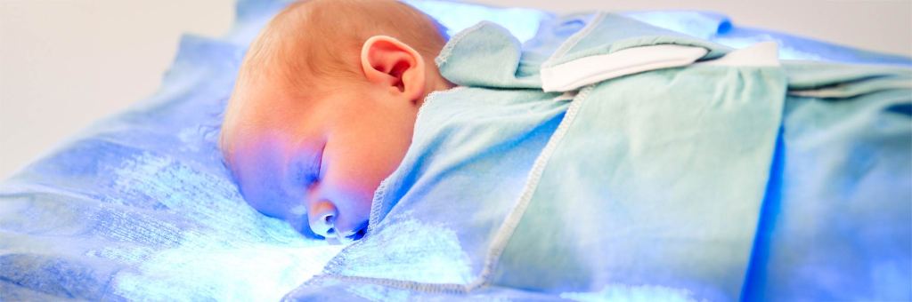 Understanding jaundice in newborns | Health Partners Blog Understanding jaundice in newborns | Health Partners Blog