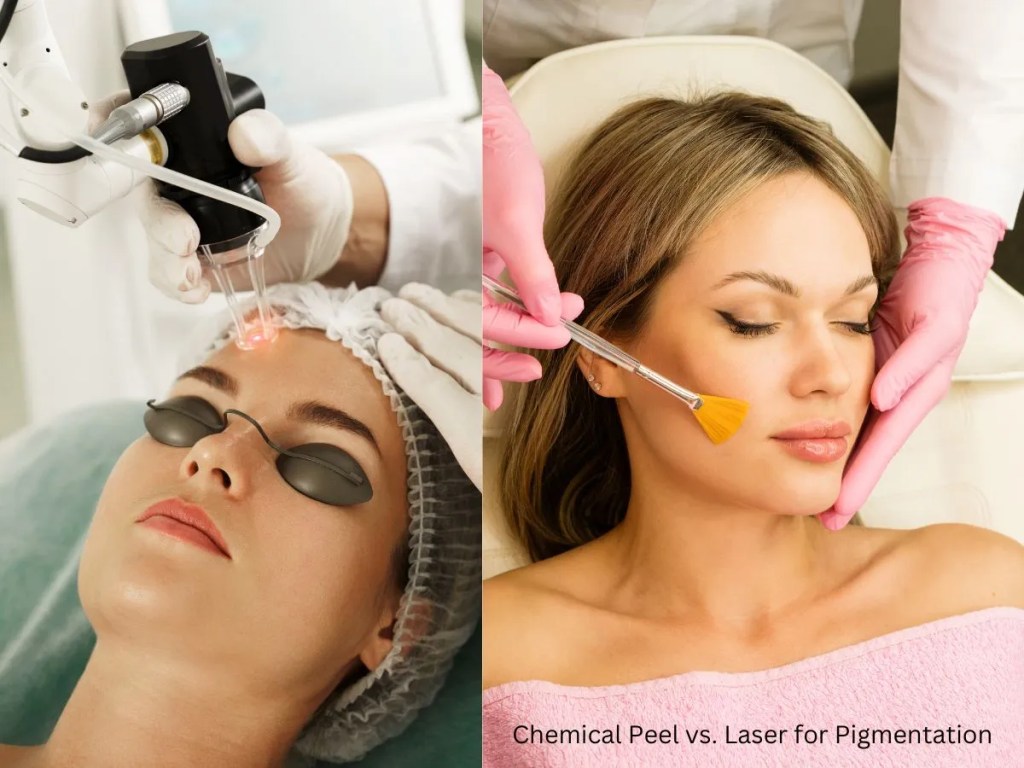 Chemical peel vs. laser for pigmentation Chemical peel vs. laser for pigmentation