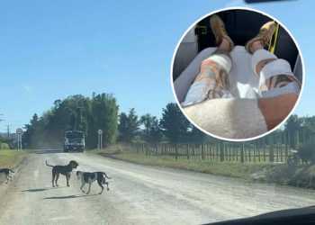 Dog attack victim reports history of complaints before Kaipara incident Dog attack victim reports history of complaints before Kaipara incident