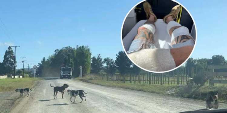 Dog attack victim reports history of complaints before Kaipara incident Dog attack victim reports history of complaints before Kaipara incident
