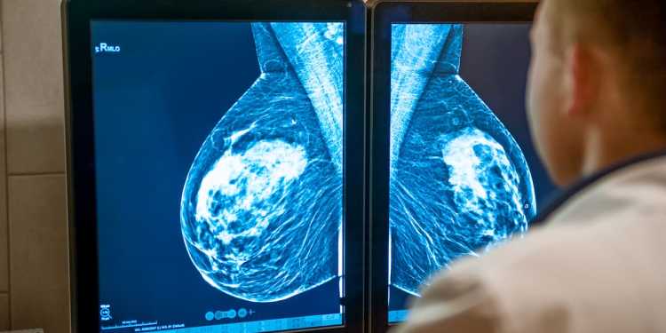 Breast mammogram ordeal: Kiwi women’s implants burst during routine screening Breast mammogram ordeal: Kiwi women’s implants burst during routine screening