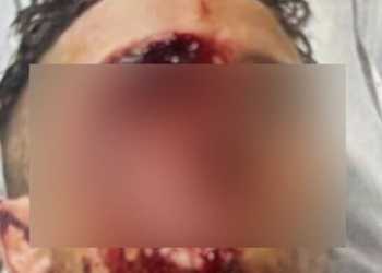 Shane Khan sentenced for baseball bat attack in Hamilton Shane Khan sentenced for baseball bat attack in Hamilton