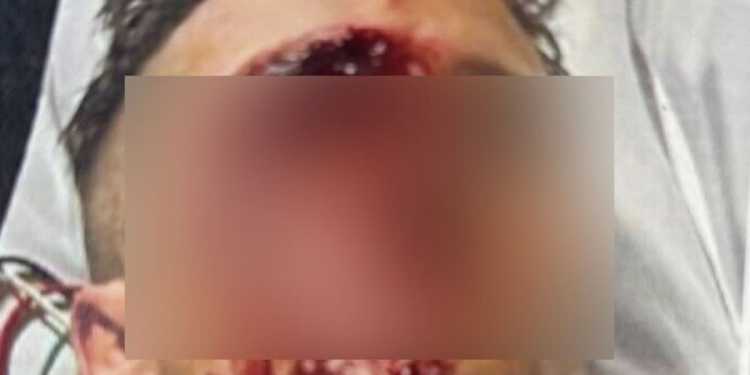 Shane Khan sentenced for baseball bat attack in Hamilton Shane Khan sentenced for baseball bat attack in Hamilton