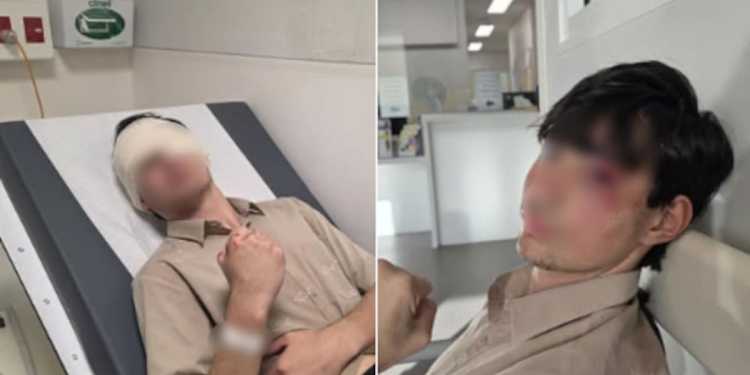 Auckland train station assault: Gang of youths attack teen and steal his 0 Nike sneakers Auckland train station assault: Gang of youths attack teen and steal his 0 Nike sneakers