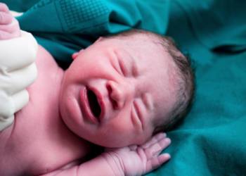 Tongue-tie surgeries: Warning as procedures on newborns triple Tongue-tie surgeries: Warning as procedures on newborns triple