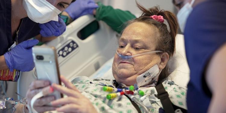 A woman who received a pig kidney transplant plus a heart pump has died A woman who received a pig kidney transplant plus a heart pump has died