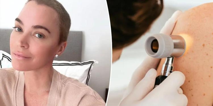 What to know about dangerous ‘black tumor’ cancer that’s spread to Teddi Mellencamp’s lungs and brain What to know about dangerous ‘black tumor’ cancer that’s spread to Teddi Mellencamp’s lungs and brain