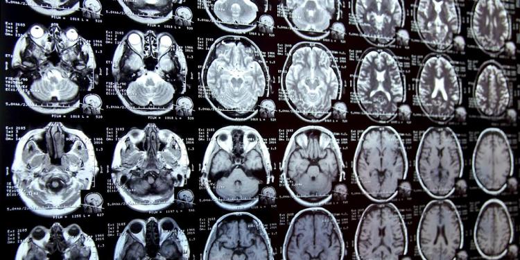 ‘This stuff is increasing in our world exponentially’ ‘This stuff is increasing in our world exponentially’